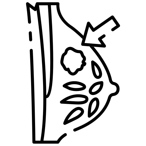 Breast lump icon